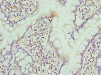 NMU Antibody