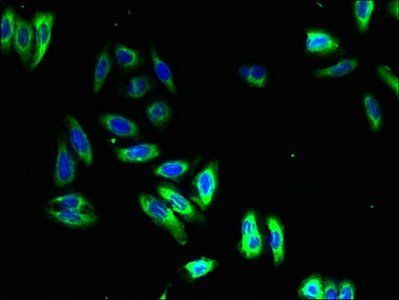 NMUR1 Antibody