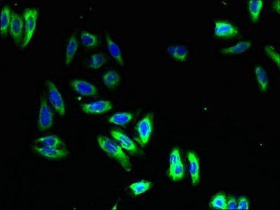 NMUR1 antibody