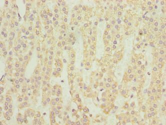 NMUR1 antibody