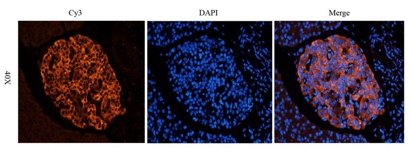 NMUR2 antibody