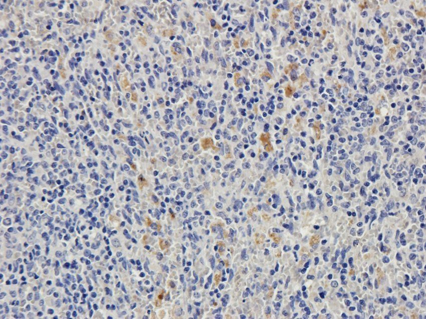 NMUR2 antibody