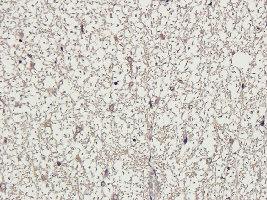 NMUR2 antibody