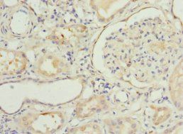 NNMT Antibody