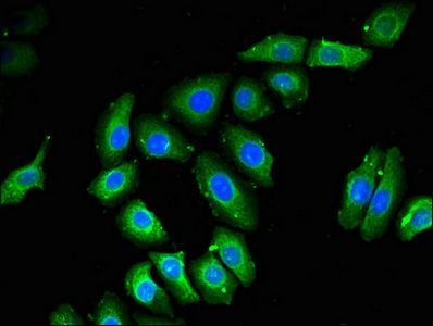 NOB1 antibody