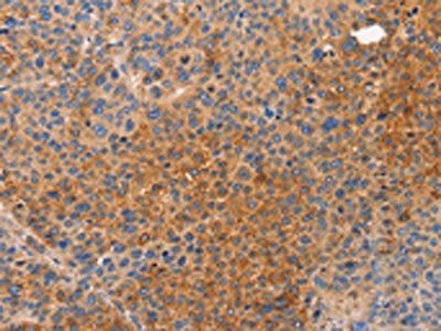 NOD1 Antibody