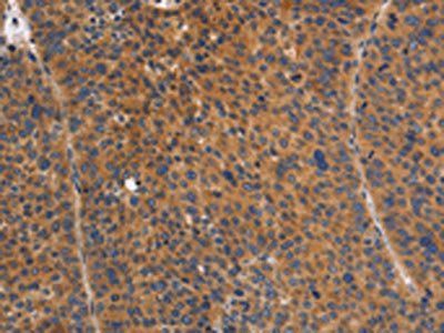 NOD1 Antibody