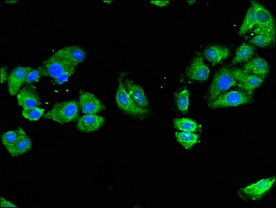 NOD2 Antibody