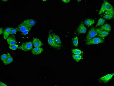 NOD2 antibody