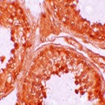NOD6 Antibody