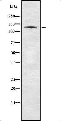 Nogo A Antibody