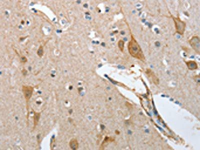 NOL3 Antibody