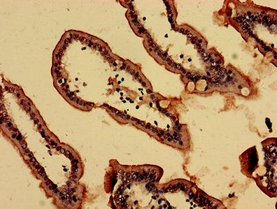 NOL4L Antibody