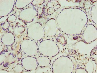 NOL4L Antibody