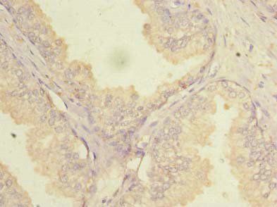 NOL6 Antibody