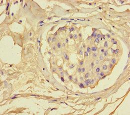 GSDME Antibody