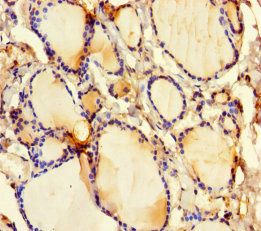 GSDME Antibody