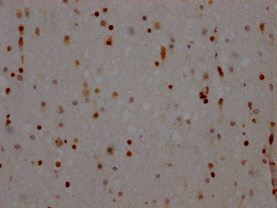 NONO Recombinant Monoclonal Antibody