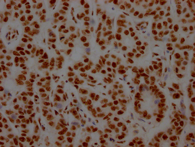 NONO Recombinant Monoclonal Antibody