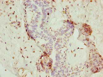 NOP10 Antibody