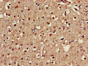 NOS1AP Antibody