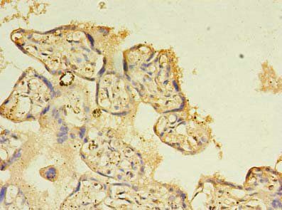 NOSTRIN antibody