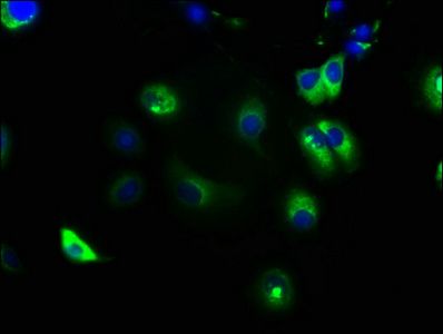 NOTCH2 Antibody