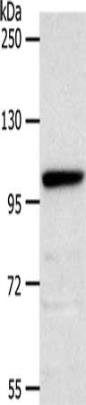 NOTCH2 antibody