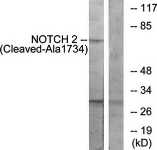 NOTCH2 (Cleaved-Ala1734) Antibody