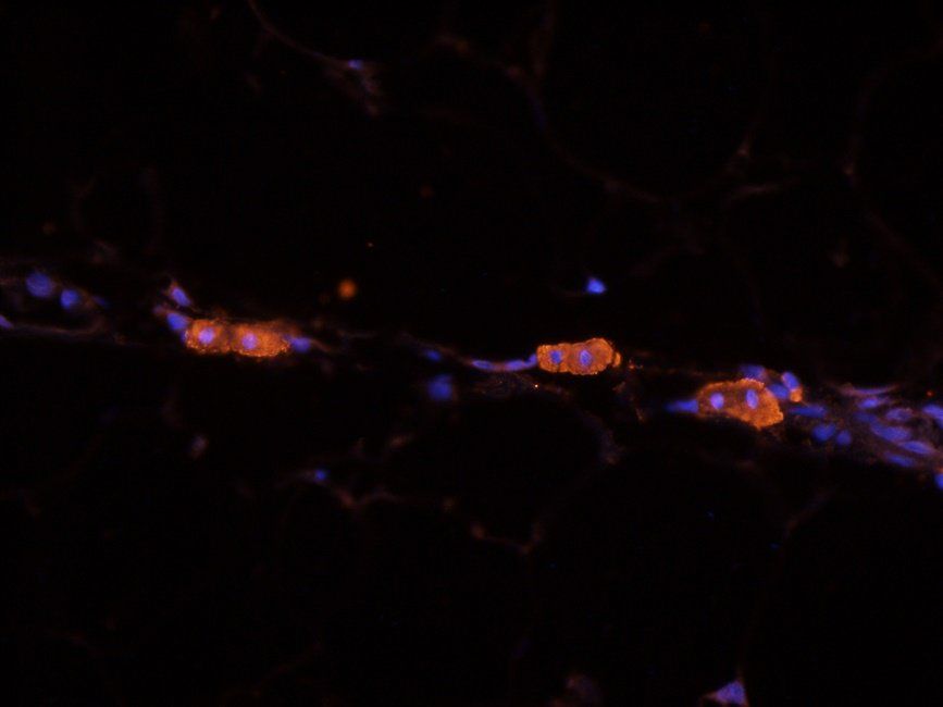 NOTCH3 antibody