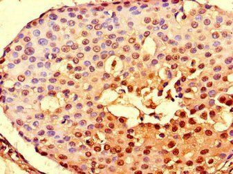 NOTCH3 Antibody