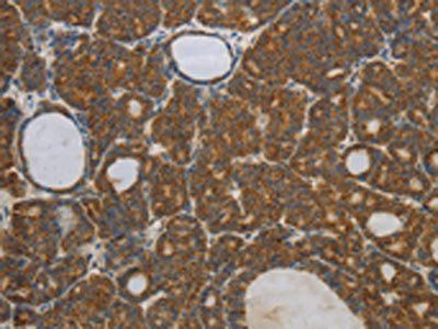 NOTCH4 Antibody