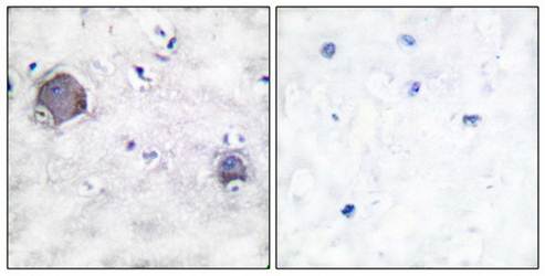 Notch 1 (Cleaved-Val1754) antibody
