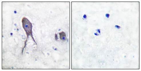 Notch 2 (Cleaved-Asp1733) Antibody