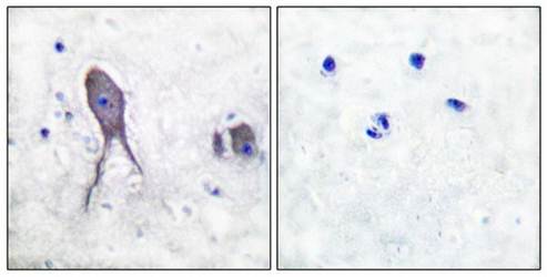 NOTCH2 (Cleaved-Asp1733) antibody