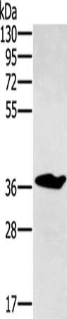 NOV antibody