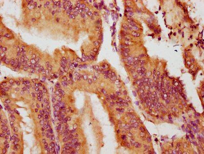 NOX1 Antibody
