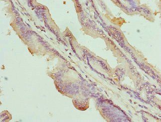 NOX5 Antibody