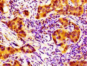 NPAS2 Antibody