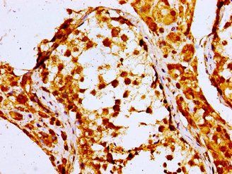 NPC1 Antibody