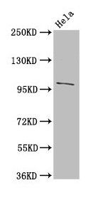 NPC1 Antibody