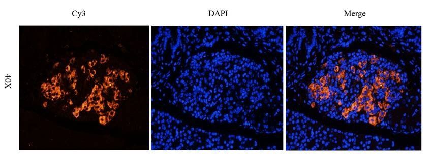 NPC1 antibody