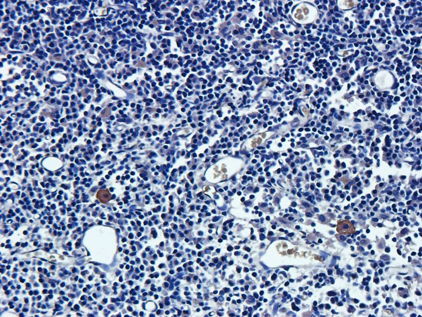 NPC1 antibody