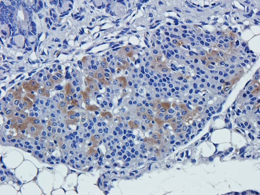 NPC1 antibody