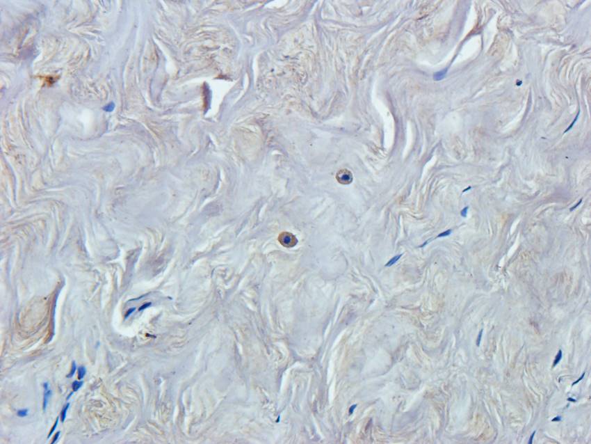 NPC1 antibody