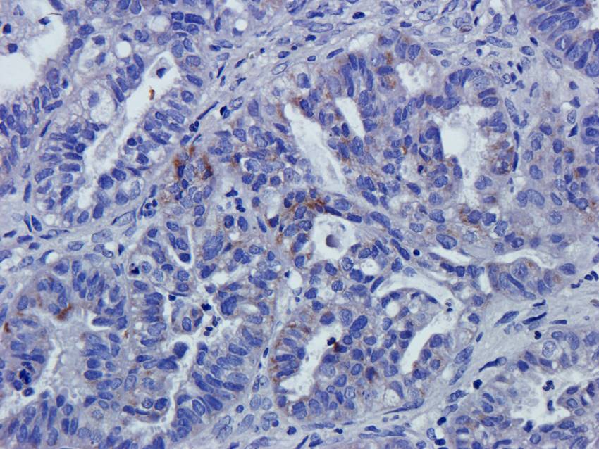 NPC1 antibody