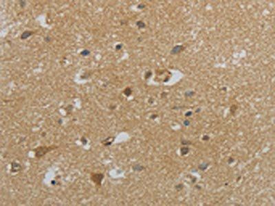 NPHS1 Antibody