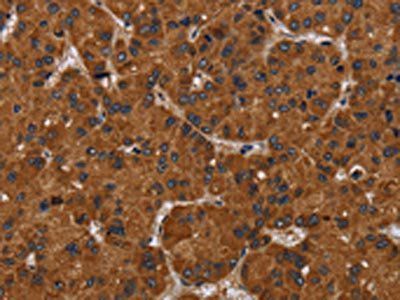 NPHS2 Antibody