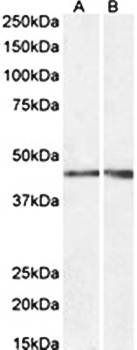 NPHS2 antibody