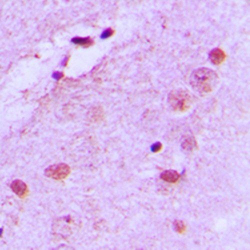 Nucleophosmin (phospho-T199) antibody